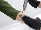 
Things to consider while tattoo removal
