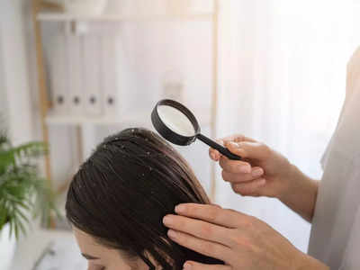 Anti-dandruff shampoo under 500: Get flake-free hair (May, 2024)