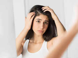 Does oiling hair increase dandruff?