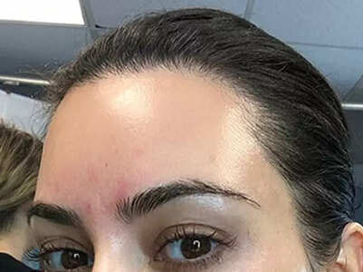 Celebs who have opened up about their skin diseases