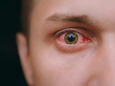 5 natural ways to maintain good vision