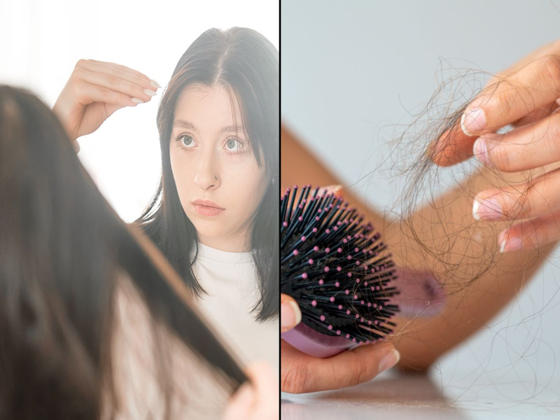 Coronavirus: From getting a bald patch to losing hair volume; experts explain hair fall and thinning during the COVID pandemic