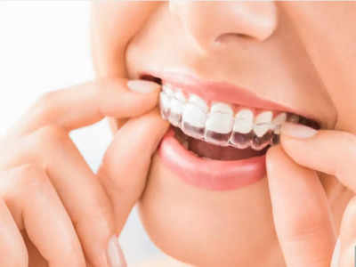 The dental health benefits of clear aligners - Times of India