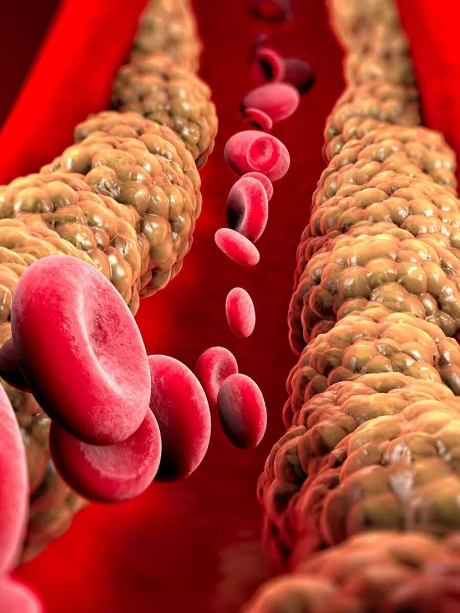 top-5-effortless-ways-to-reduce-cholesterol-without-statins-times-now