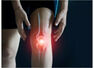 Things you can do to protect your knees