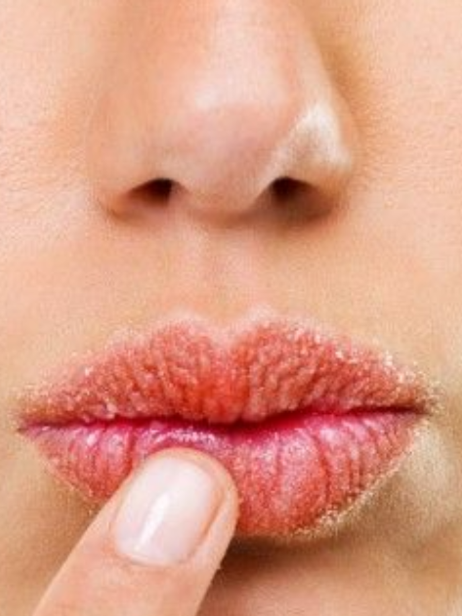 Dark lips remedy DIY lip scrubs to treat dark lips at home Times Now