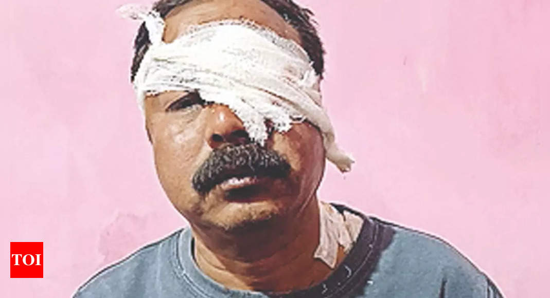डिब्रूगढ़ रिहायशी इलाके में घुसा तेंदुआ, 2 पर हमला |  गुवाहाटी समाचार – टाइम्स ऑफ इंडिया