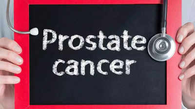 Study reveals right time to undergo Prostate Cancer treatment - Times ...