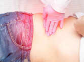 Signs of kidney stones to not overlook