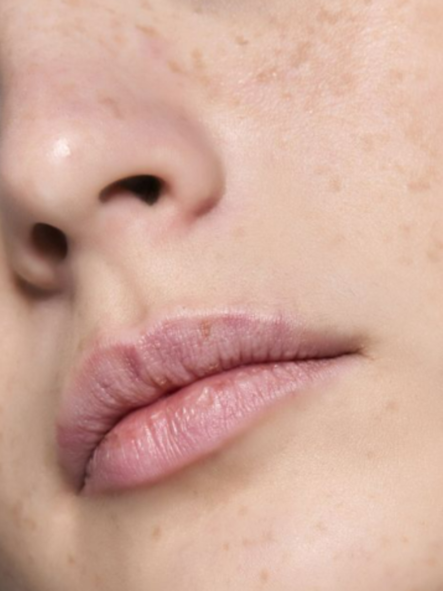 dry-lips-remedy-simple-ingredients-to-treat-dry-lips-at-home-times-now