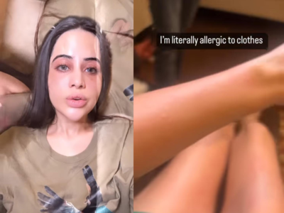 Urfi Javed shares pics of rashes on her legs, reveals "I cannot wear woollen clothes at all"