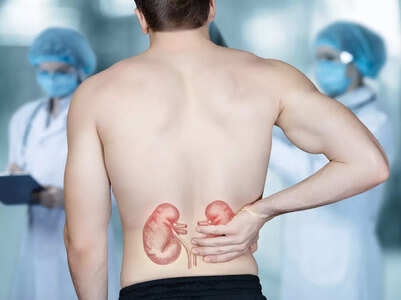 5 early symptoms of kidney stones 