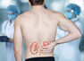 5 early symptoms of kidney stones 