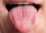 Areas in your mouth that can signal mouth cancer