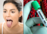 Tongue color may signal high cholesterol