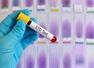 Common STD myths debunked!