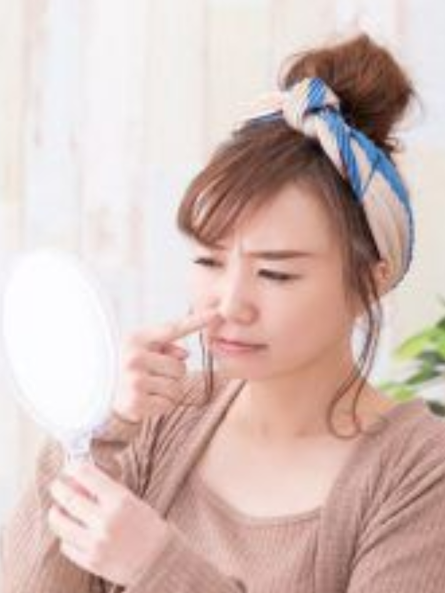 Oily nose home remedy Get rid of oily nose with these simple home