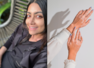 Actor Mamta Mohandas diagnosed with vitiligo
