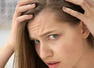 Women too suffer from receding hairline