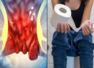 These two are the first signs of bowel cancer