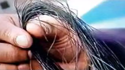 Man battles for life as string cuts throat in Nashik