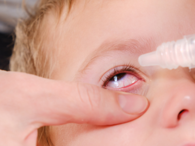 ​Childhood Glaucoma: Check these symptoms