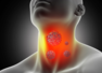 How to catch Esophageal cancer early?