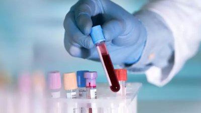 High lead levels in 57% of 147 blood samples: Pune laboratory
