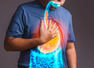 GERD: Early signs of acid reflux