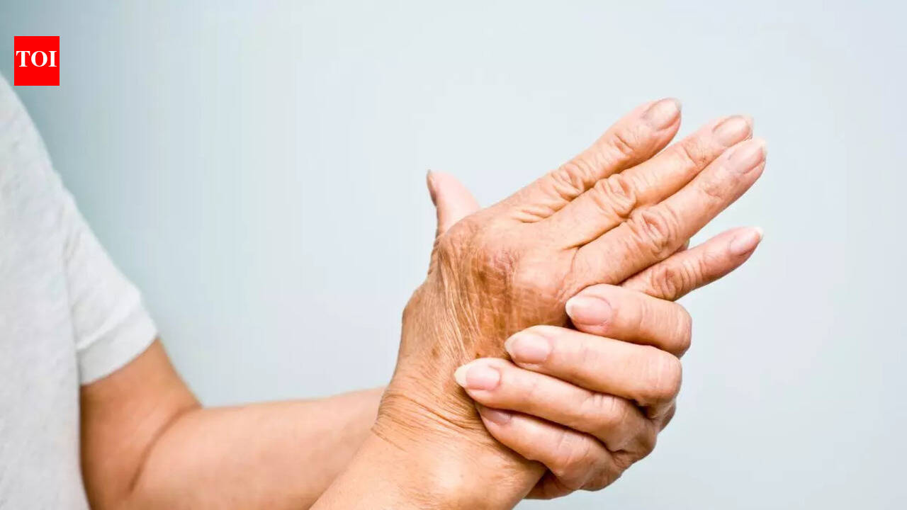Osteoarthritis Synonyms: The sign that appears in your hand