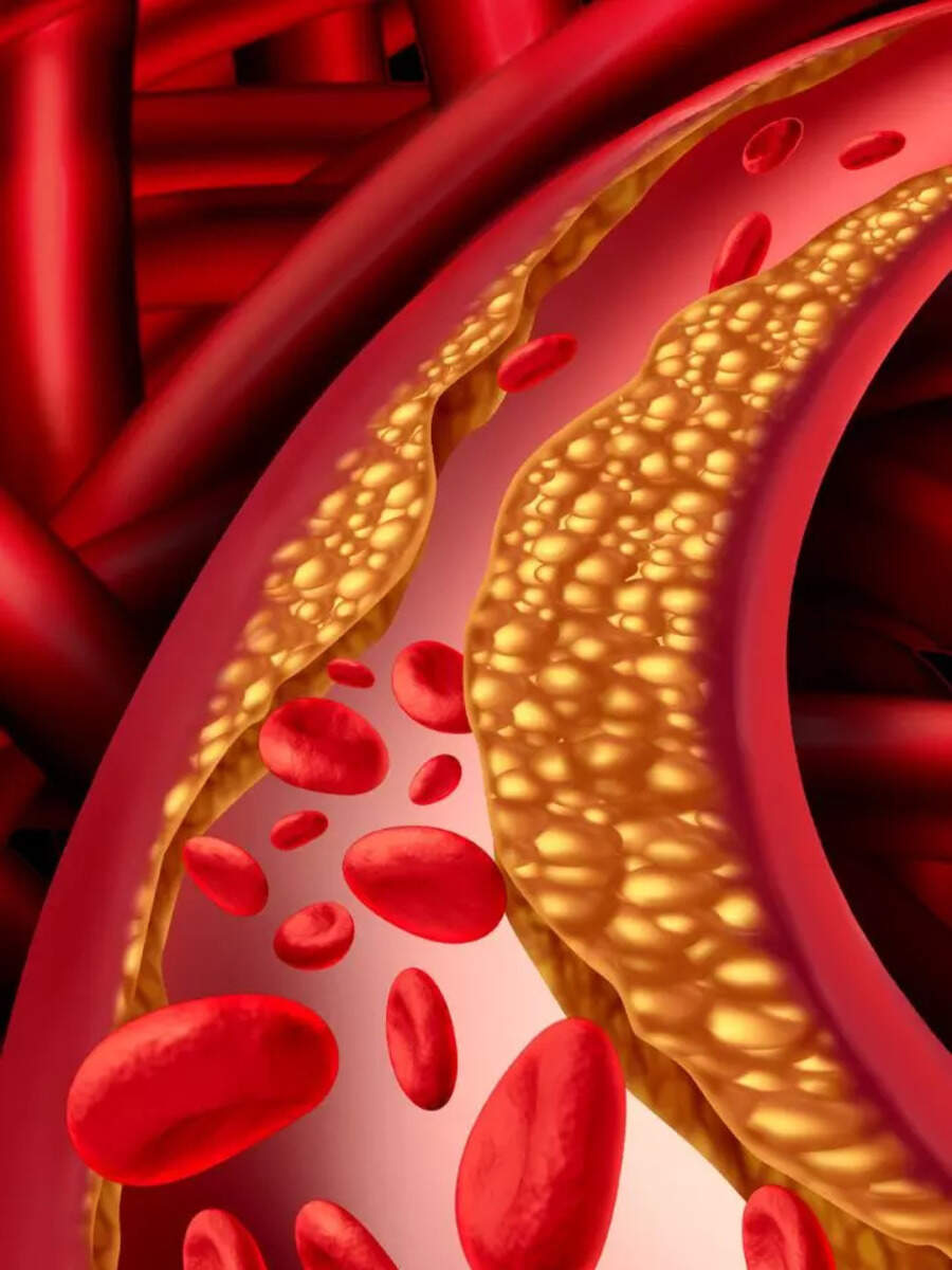 Heart health 19 best foods to unclog arteries Times of India