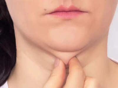 10 tips to get rid of the double chin