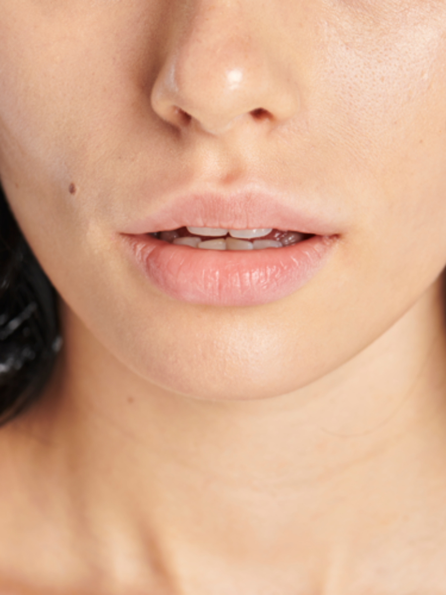 peeling-lips-use-these-home-remedies-to-heal-peeling-lips-naturally