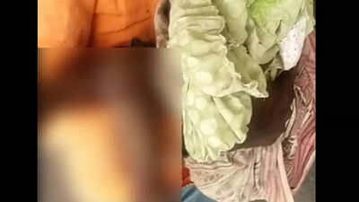 Girl, 2, who suffered 60 dog bites succumbs in Surat