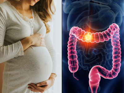 Woman with bowel cancer had constipation
