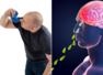 Man dies after rinsing sinuses with tap water