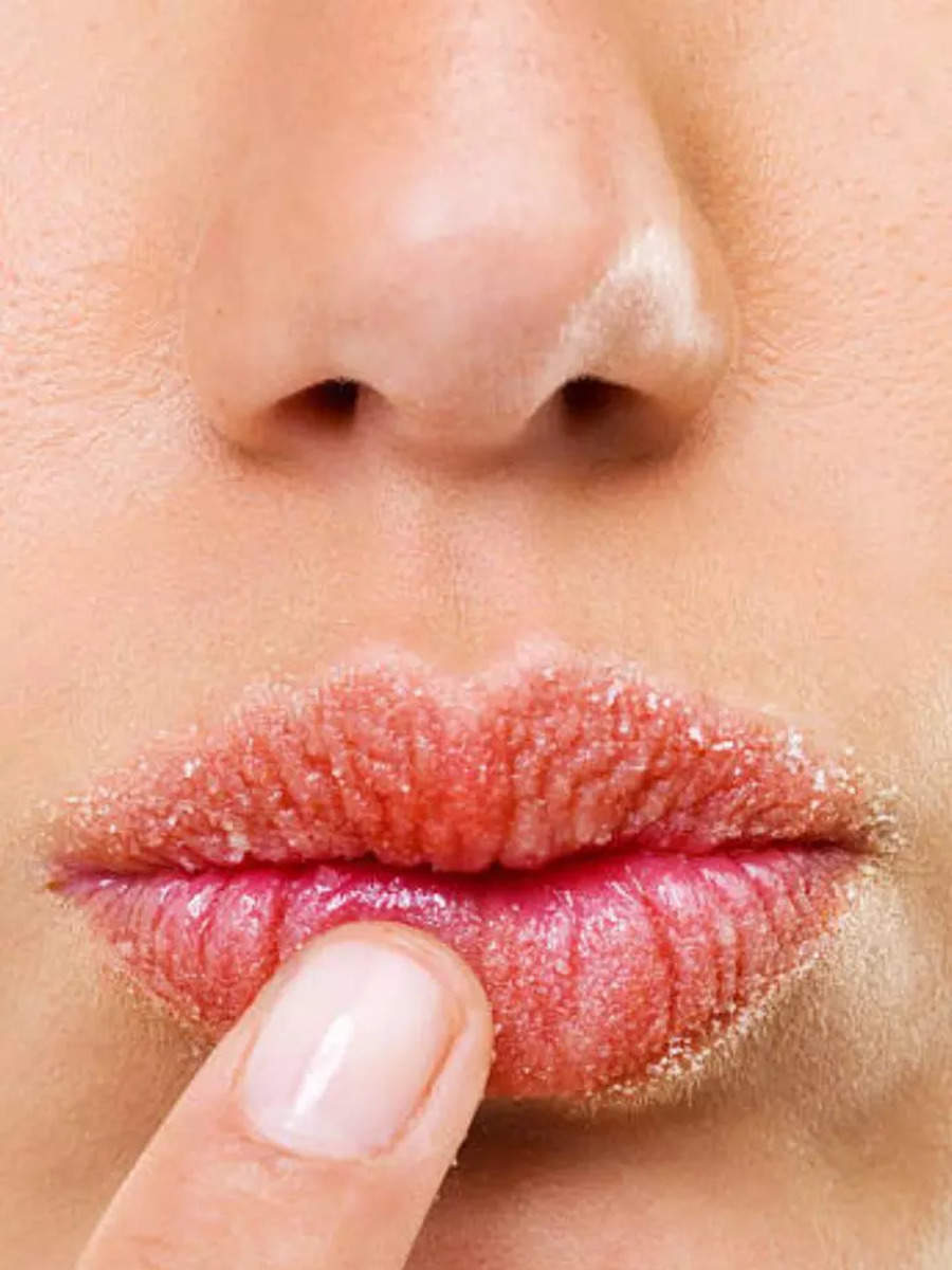 Dry Lips Remedy Dry Lips Home Remedies Say Goodbye To Chapped Lips