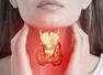 9 foods to improve thyroid gland functions