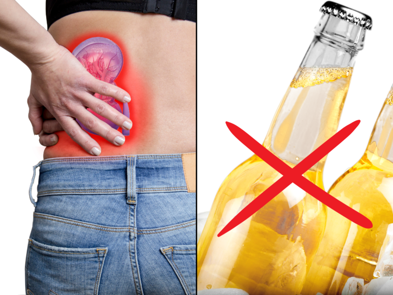 Myth busting: Study reveals 1 in 3 Indians believe beer consumption helps treat kidney stones; doctors stress on timely and correct treatment