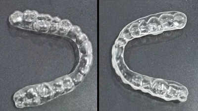 DIY teeth aligners? Experts say don't rush, chew over it