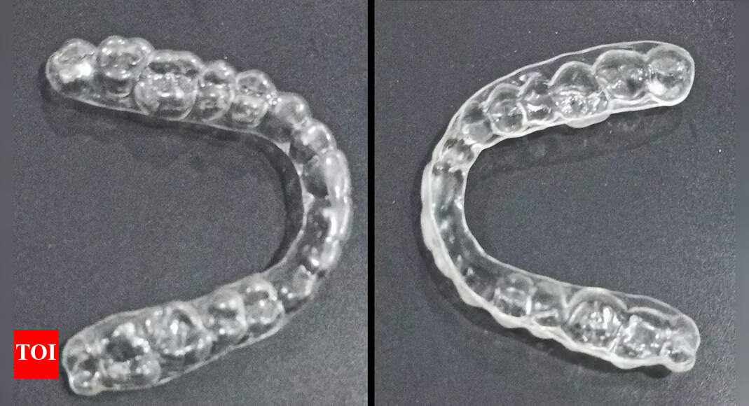 DIY teeth aligners? Experts say don't rush, chew over it | Bengaluru ...