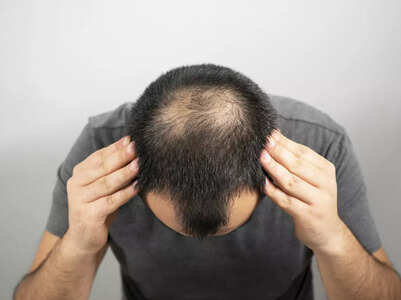 Which are the 10 best hair oils for people who are going bald?
