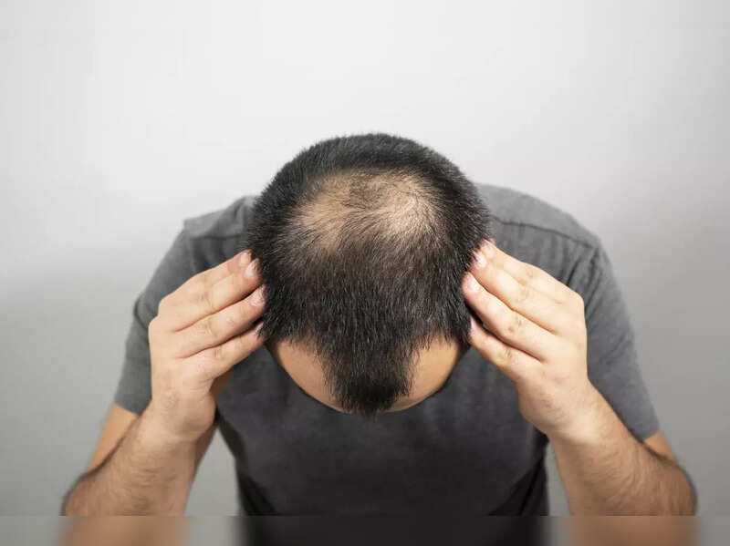 Which are the 10 best hair oils for people who are going bald?