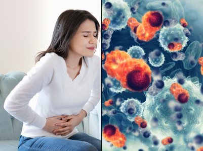 Subtle signs of ovarian cancer to not ignore