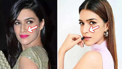 Netizens feel Kriti Sanon has done a nose job, say 'this is how plastic surgery should be done...'