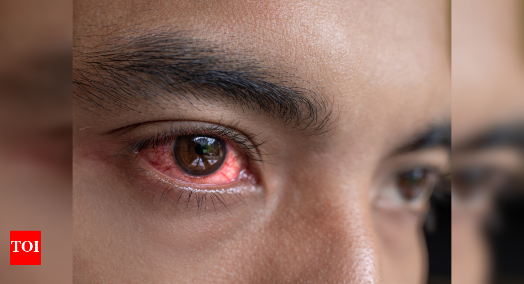 Dry eyes, Myopia and more: 5 reasons you're getting these eye problems ...