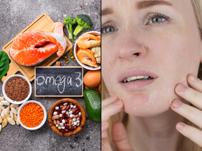 Dry skin could be a sign of omega-3 deficiency