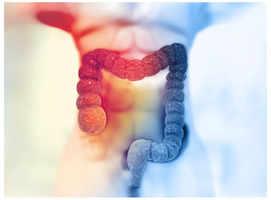 Colon cancer on rise: Don't miss these early signs