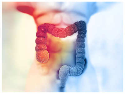 Colon cancer on rise: Don't miss early signs