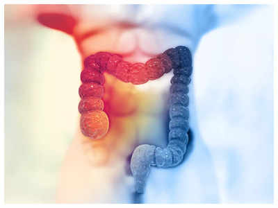 Colon cancer symptoms: As colorectal cancer cases increase in India, do not miss these early signs